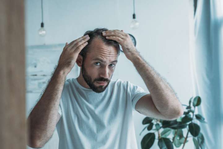 Calvitie, chute de cheveux : les meilleures solutions naturelles